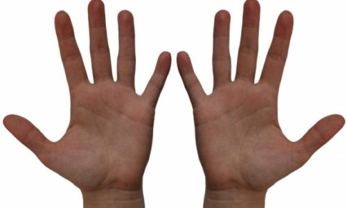 10 pytań o łuszczycę – wszystko, co trzeba o niej wiedzieć