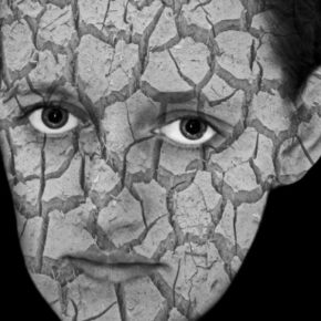 Czas na psychodermatologię