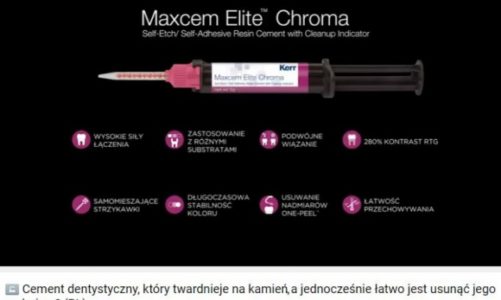 Estetyczna odbudowa zębów stała się łatwiejsza dzięki Maxcem Elite™ Chroma!