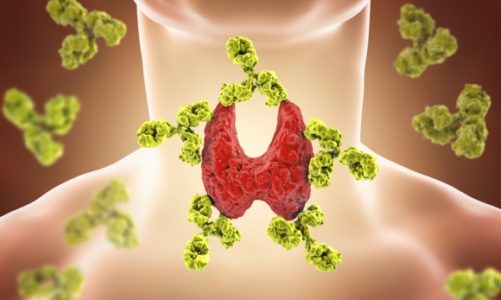 Choroba Hashimoto a dieta bezglutenowa