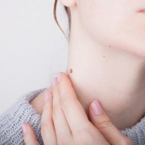 Szybka diagnoza, proste badanie – jak skutecznie walczyć z czerniakiem?